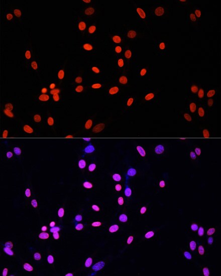 H4 Clustered Histone 1 Antibody