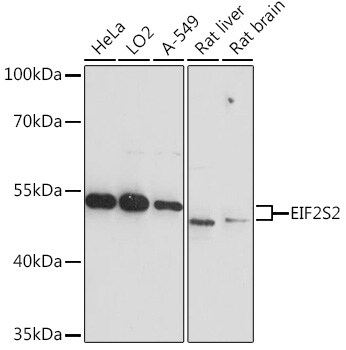 EIF2 beta Antibody
