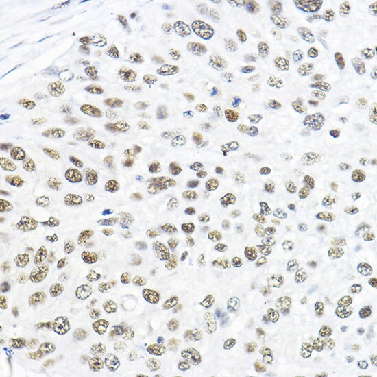 TFIIB Antibody