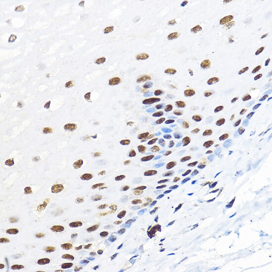 TFIIB Antibody