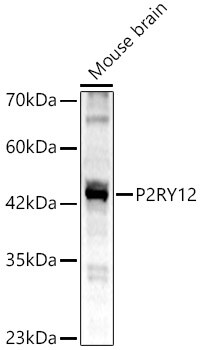 P2Y12/P2RY12 Antibody