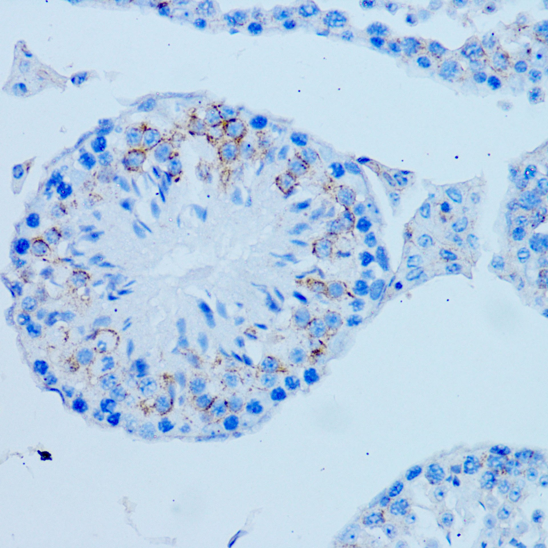 ARMER Antibody