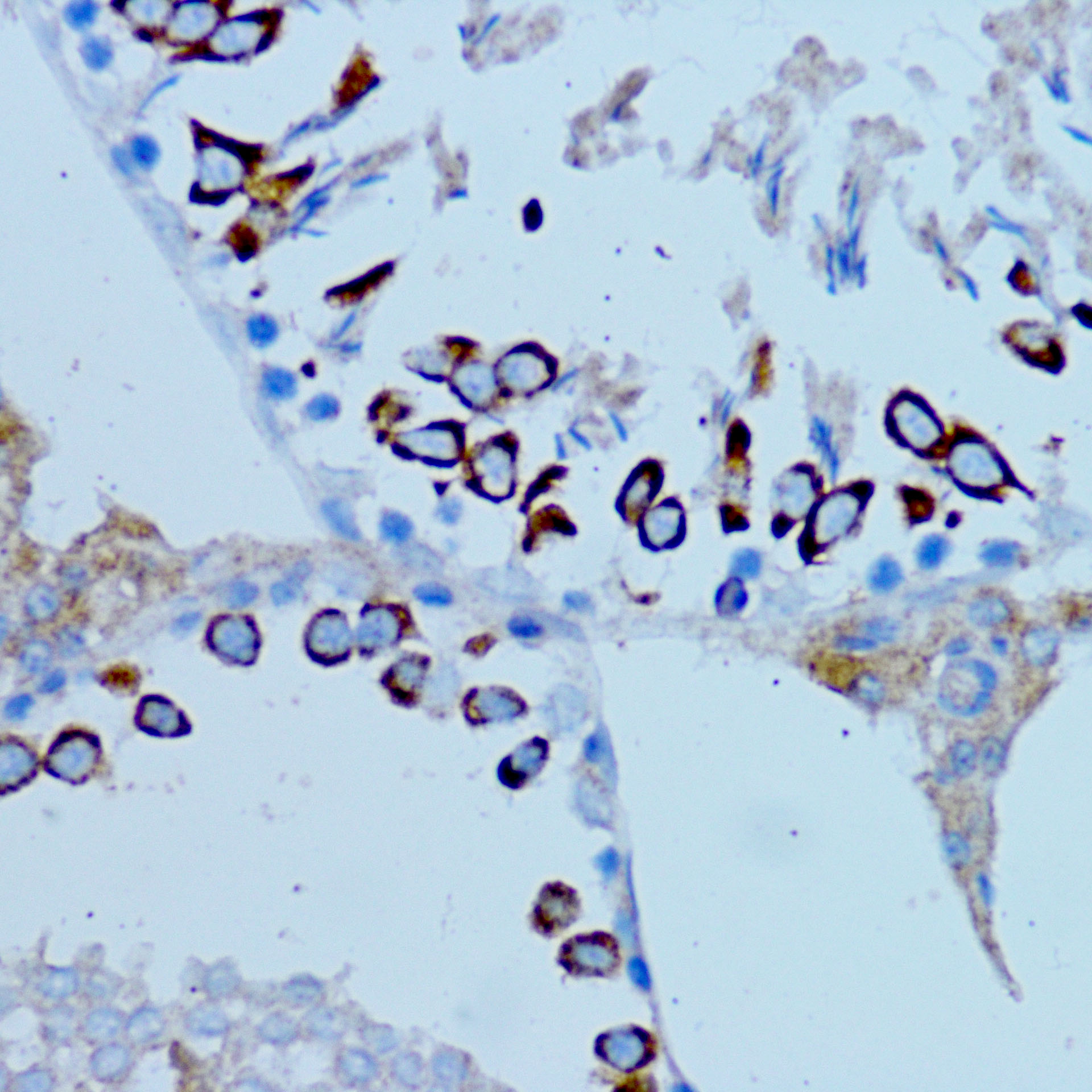 ARMER Antibody