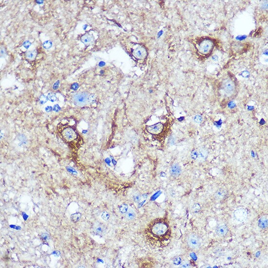 KIBRA Antibody