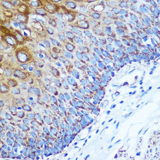 KIBRA Antibody