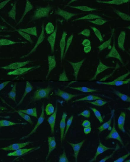 RAP6 Antibody