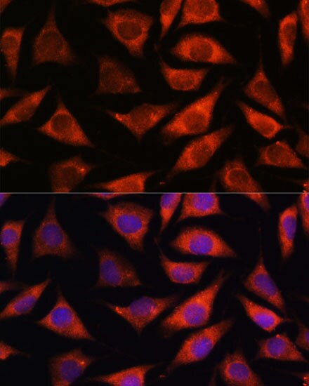 TMX2 Antibody
