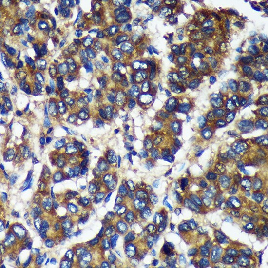TMX2 Antibody