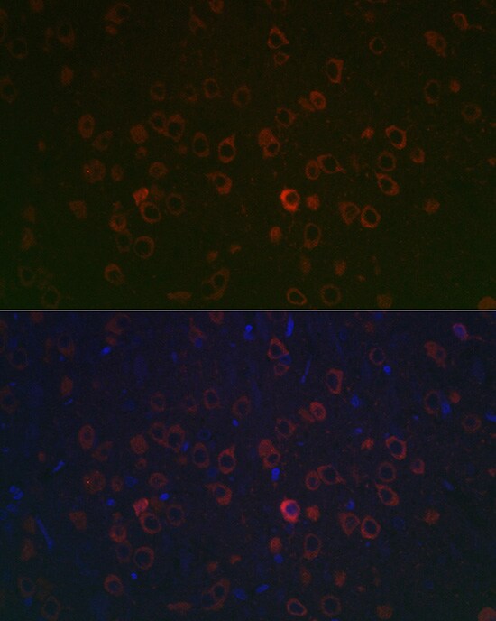 REEP2 Antibody