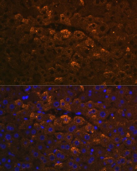 UGT1A6 Antibody