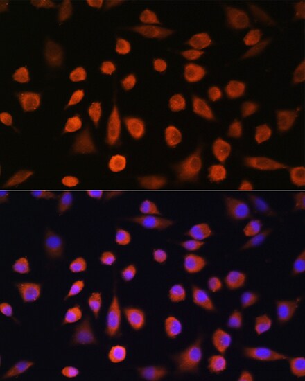 EDEM2 Antibody