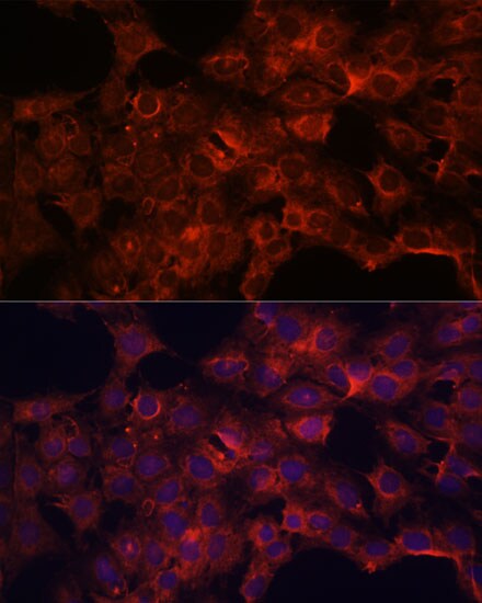PDP2 Antibody