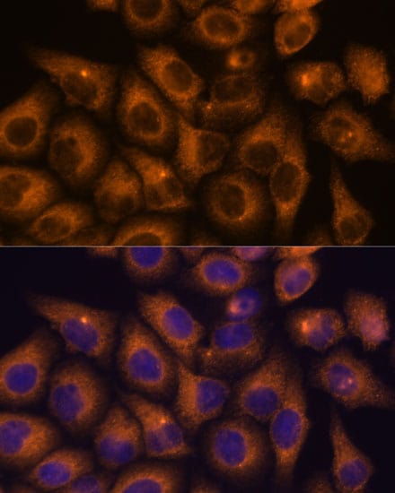 CaMKV Antibody