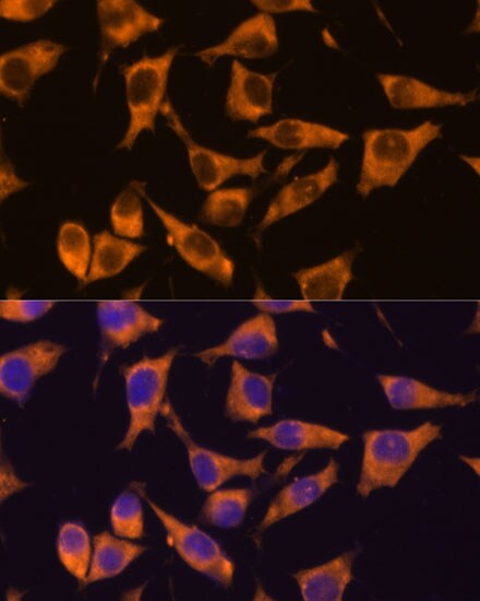 CaMKV Antibody
