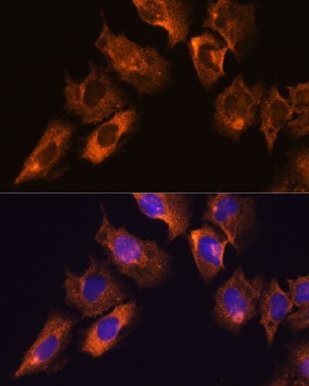 CaMKV Antibody