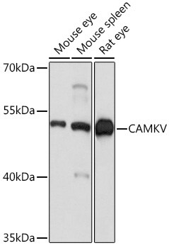 CaMKV Antibody