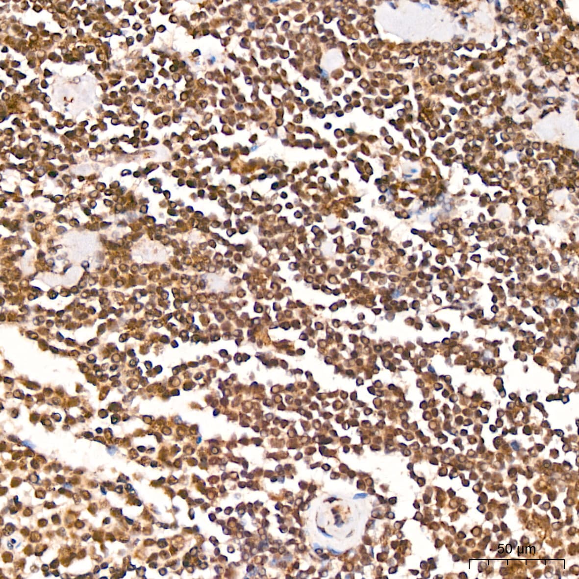 TET2 Antibody