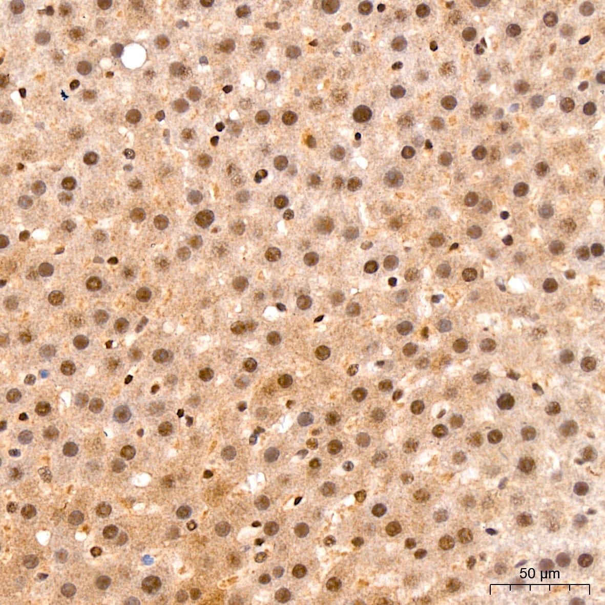 TET2 Antibody