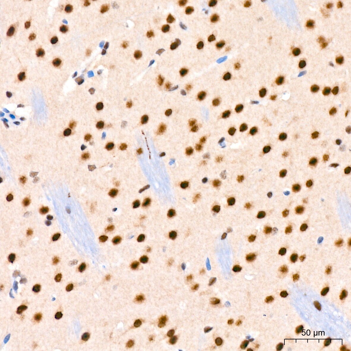 TET2 Antibody