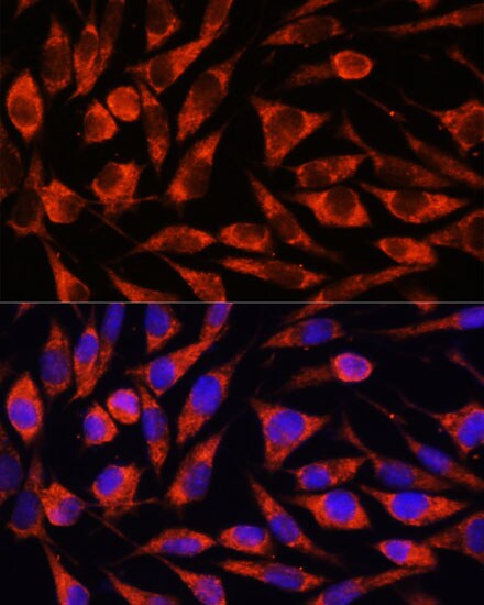 OTUD7B/Cezanne/ZA20D1 Antibody