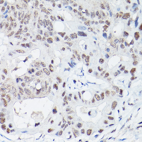 DNA Ligase IV Antibody