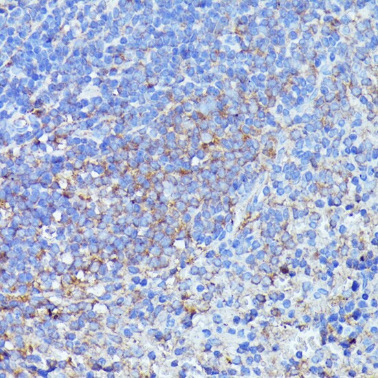 Septin-1 Antibody