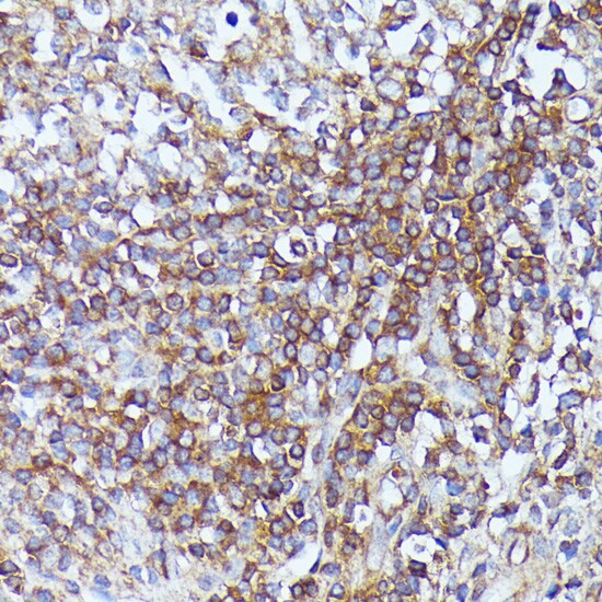 Septin-1 Antibody