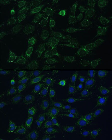 GK2 Antibody