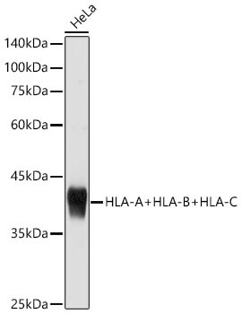 HLA A Antibody