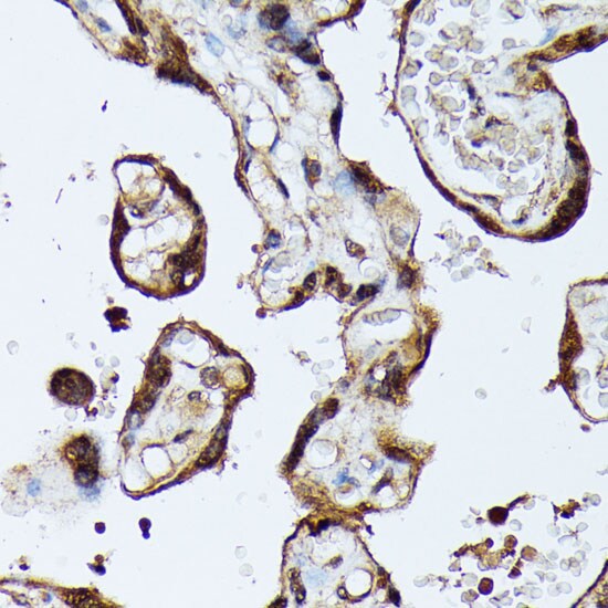 MAK Antibody
