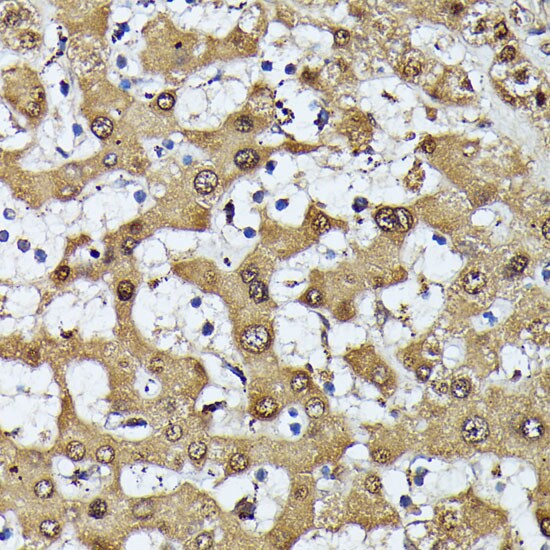 MAK Antibody