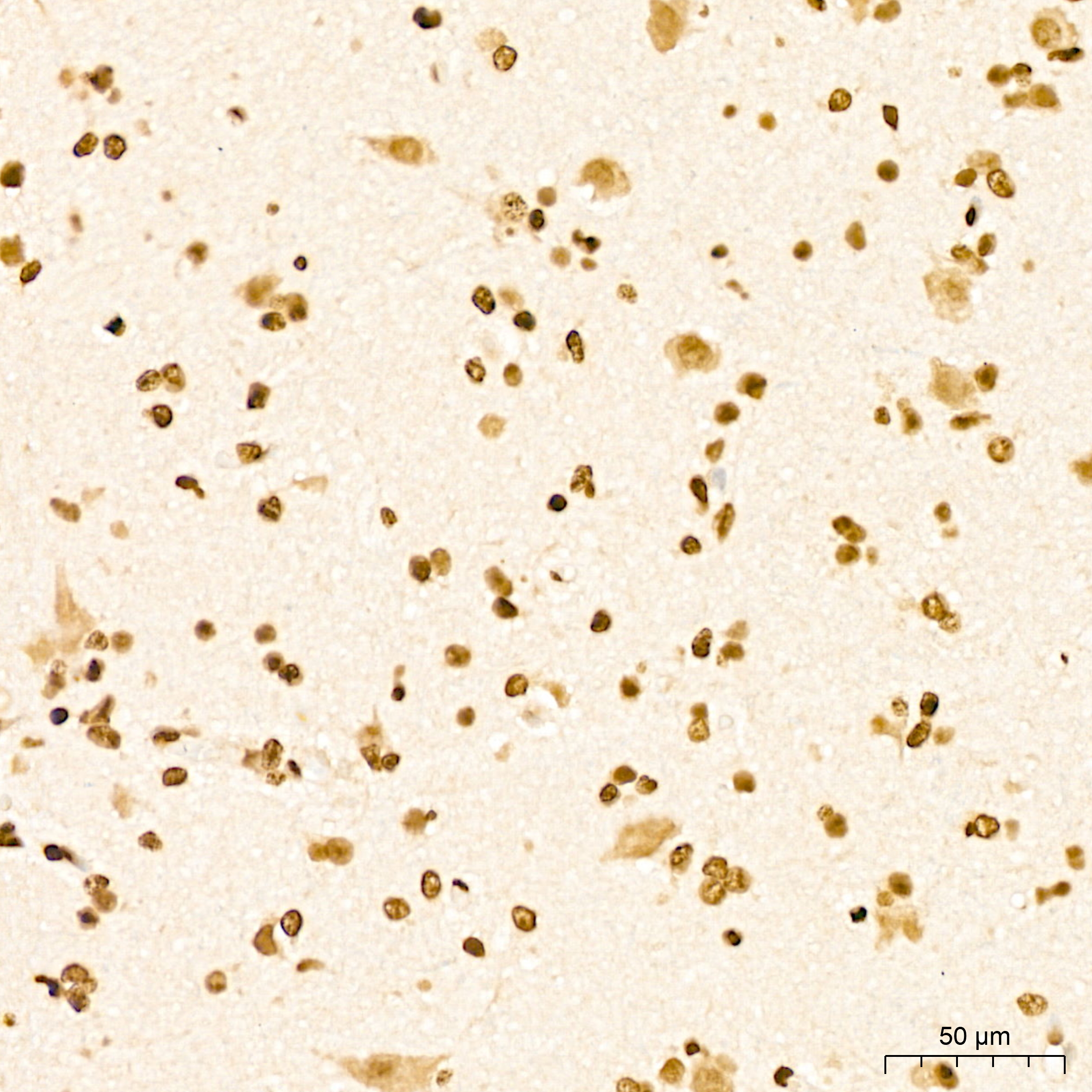 POLR2E Antibody