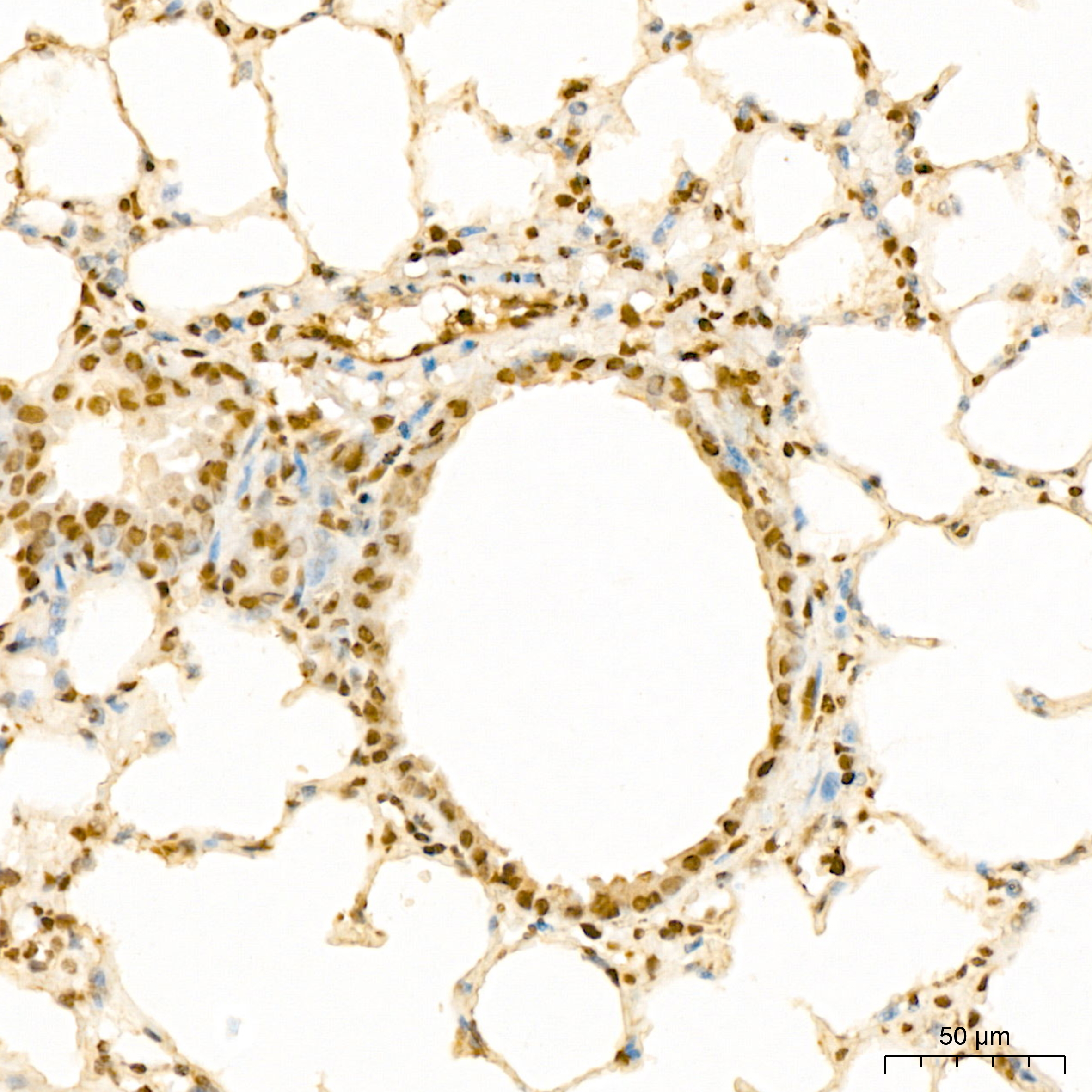 POLR2E Antibody