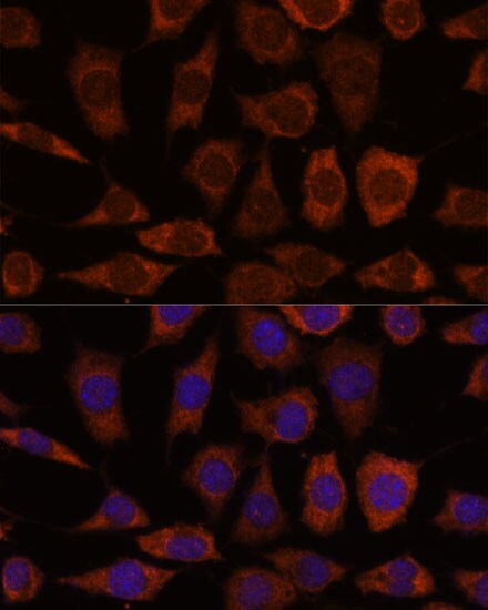 GRHPR Antibody