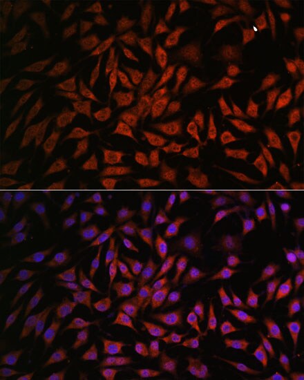NOB1 Antibody