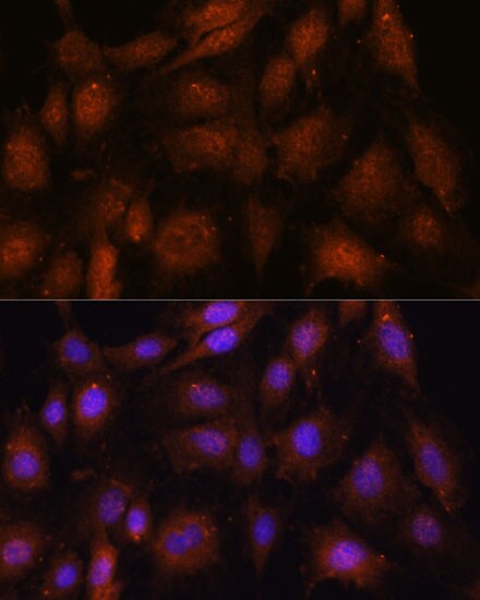 NOB1 Antibody