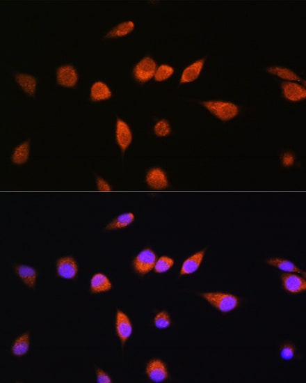 Rab20 Antibody