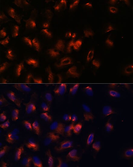 STIM2 Antibody