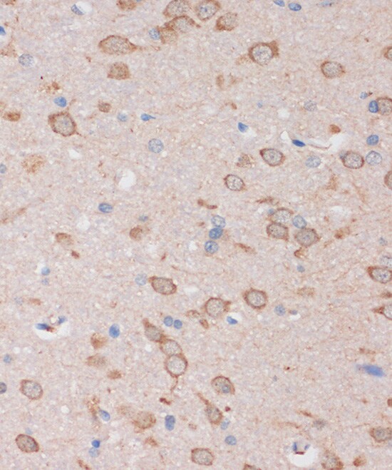 STIM2 Antibody