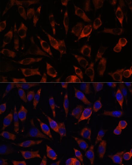 STIM2 Antibody