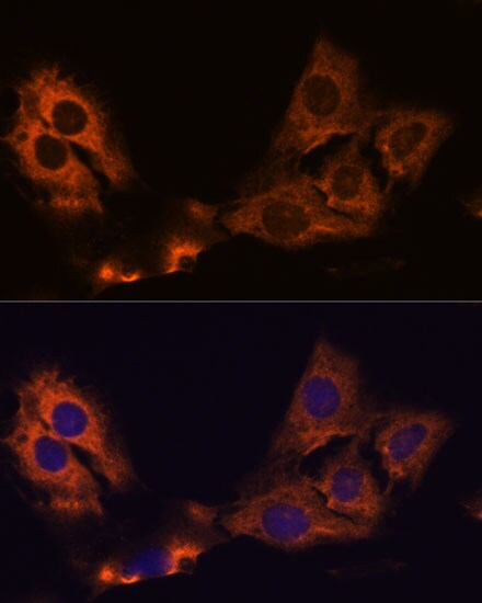 SMAP1 Antibody