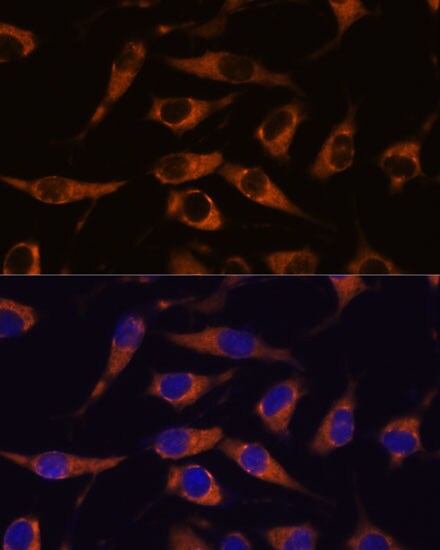 SMAP1 Antibody