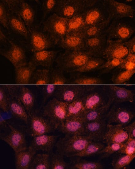 CHTF18 Antibody