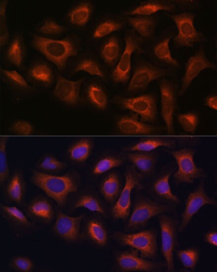 ARFGAP2 Antibody