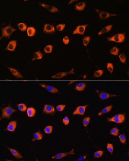 SCIN Antibody