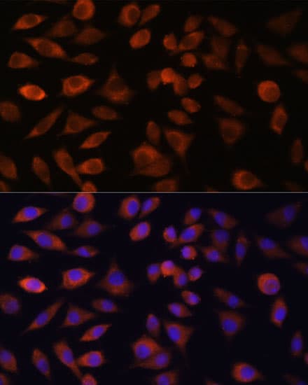 TRIM47 Antibody