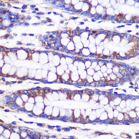 NEK9 Antibody