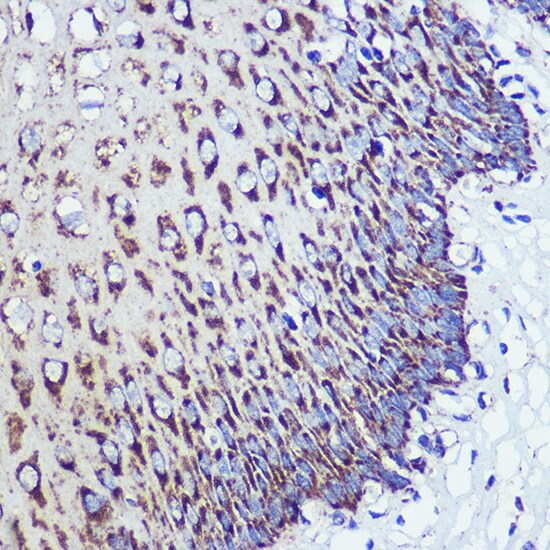 ORP8 Antibody