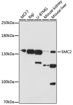 SMC2 Antibody
