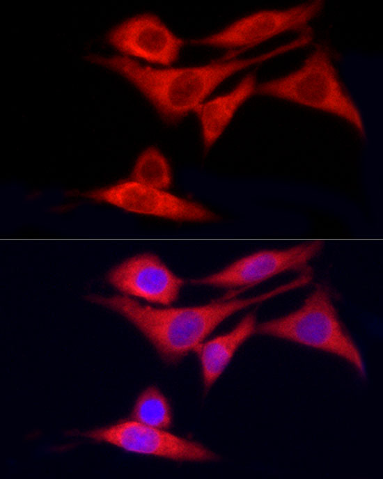 CYP7B1 Antibody
